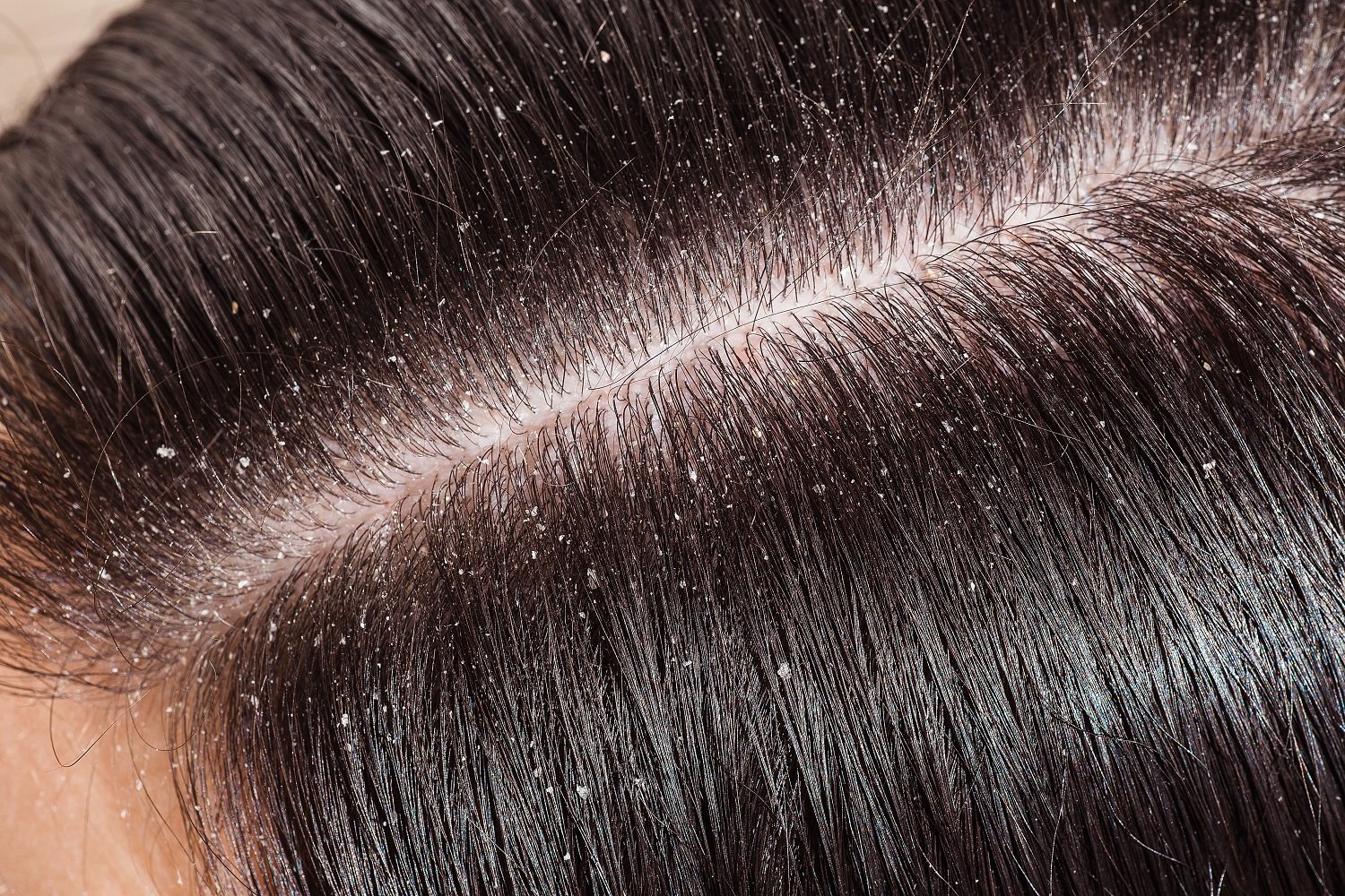 woman's unhealthy head skin